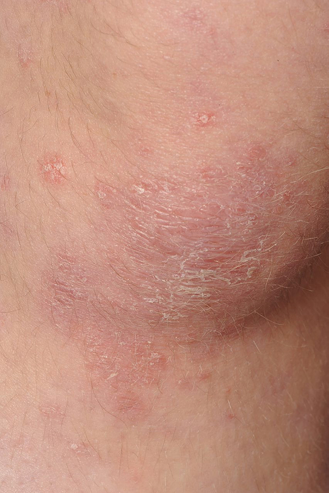 Chowdhury Dermatology at a Glance